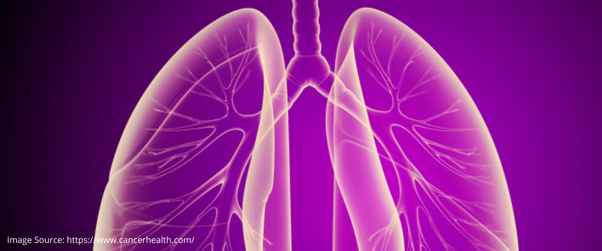 Treatment for Tuberculosis Treatment for Tuberculosis