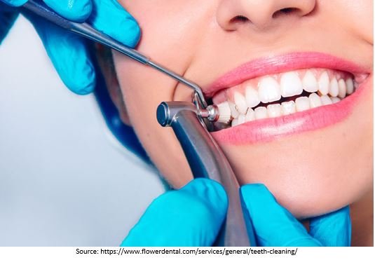 Teeth Polishing
