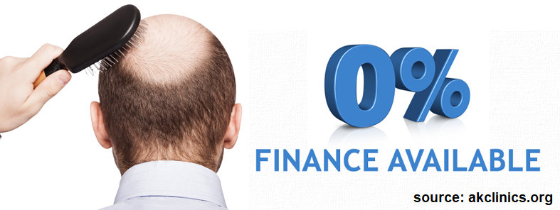 benefits of emi payment for hair transplant