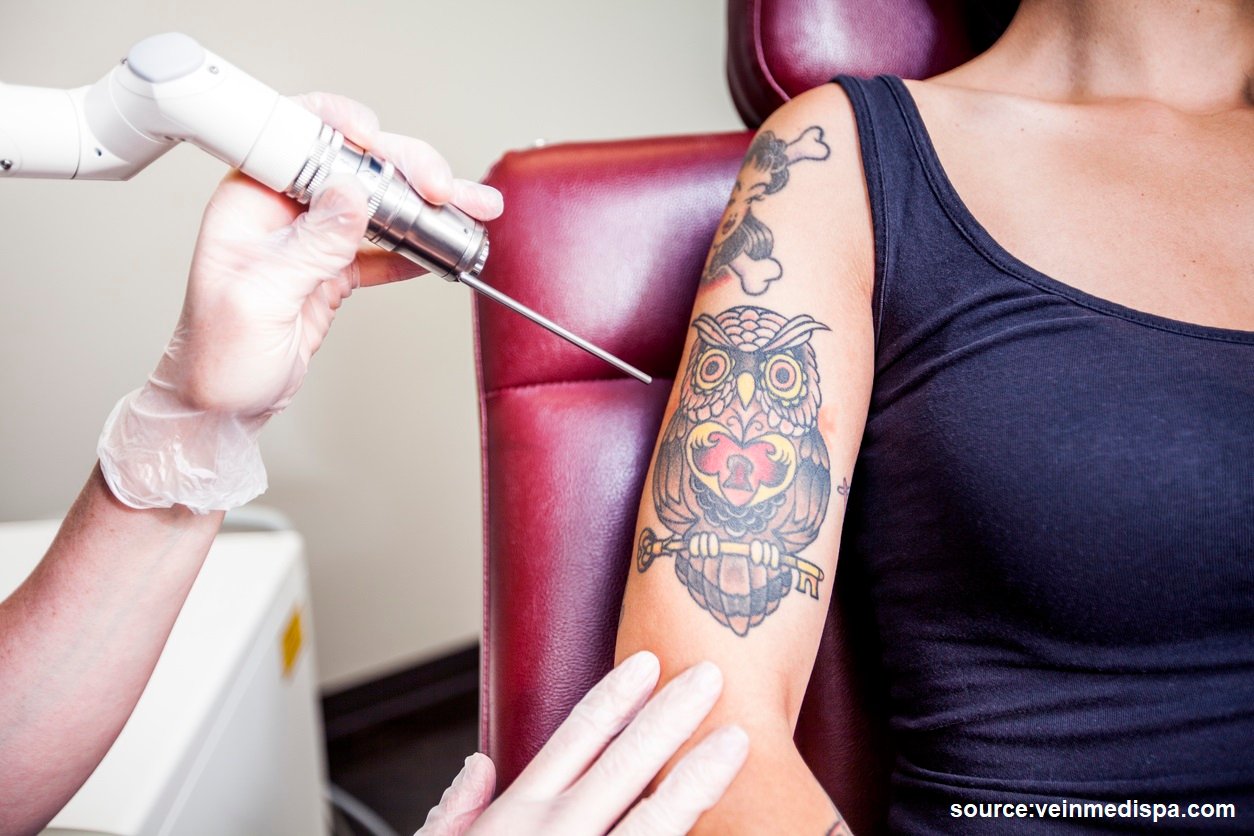 avoid tattooing over varicose veins