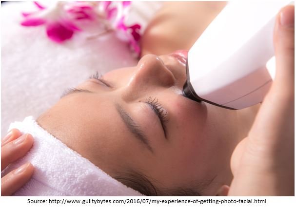 Laser skin tightening