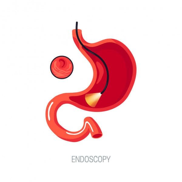 Endoscopy surgery