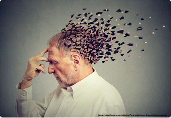 Diagnosis of Alzheimer’s disease