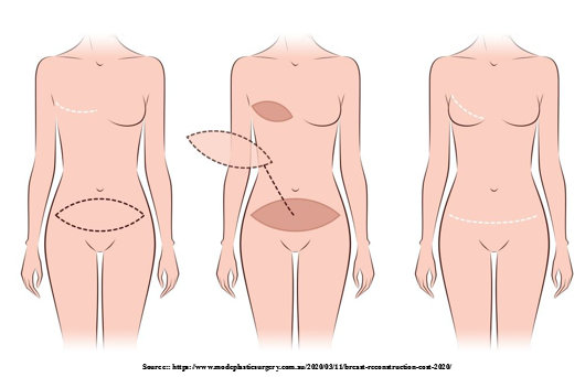 How is Reconstructive Cosmetic Surgery performed?