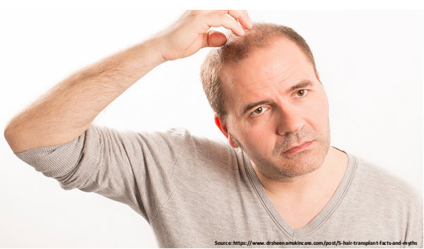 Hair transplantation