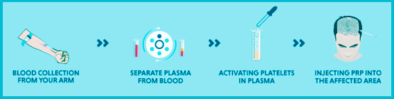 PRP treatment in Jaipur
