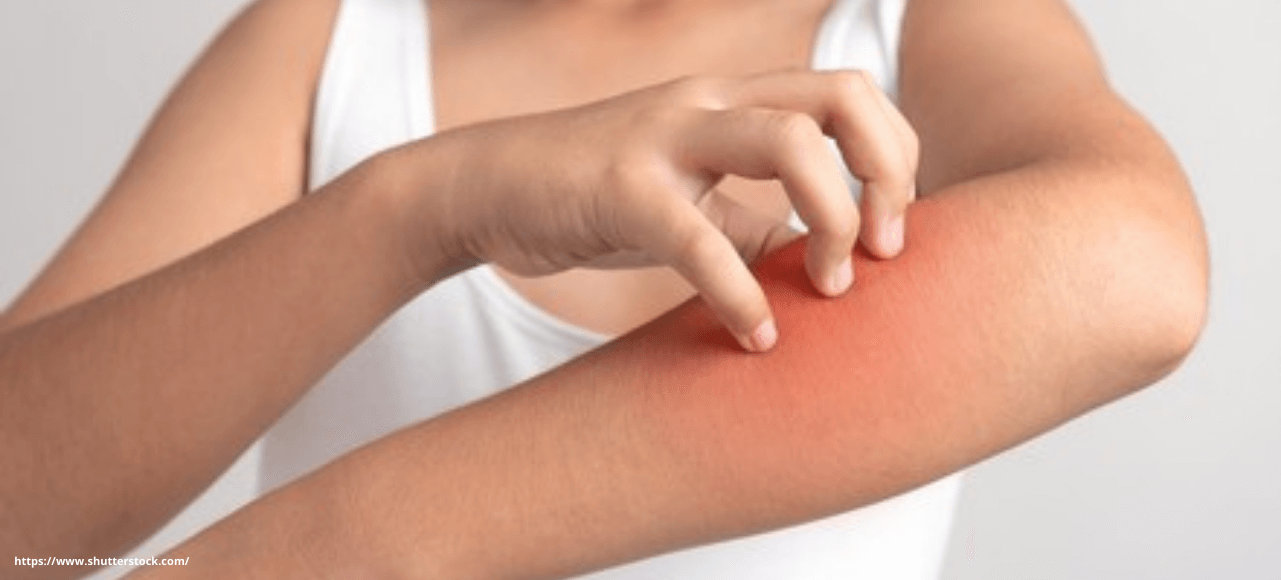Skin Itching Treatment Skin Itching Treatment
