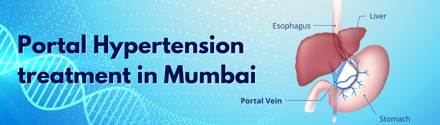 Portal Hypertension Treatment in Mumbai Portal Hypertension Treatment in Mumbai