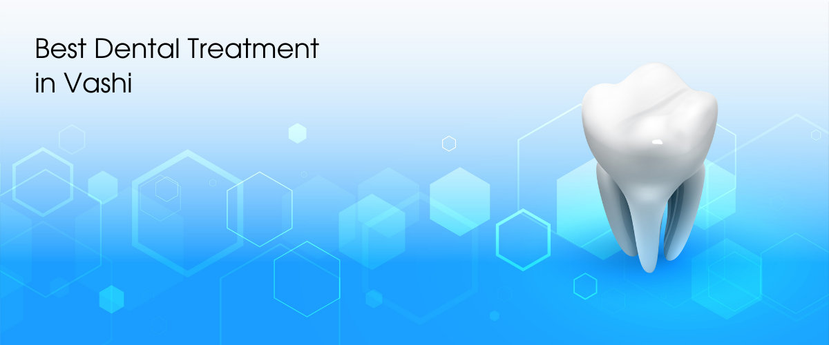 Dental Treatment in Vashi Dental Treatment in Vashi