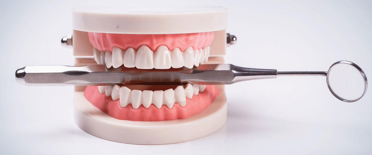 Malocclusion of Teeth Malocclusion of Teeth