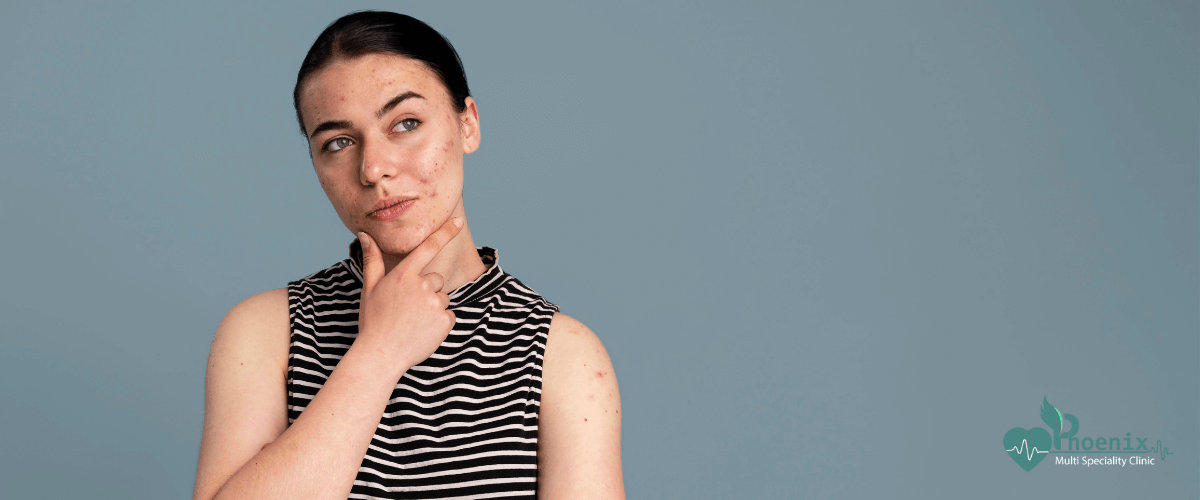 Skin Rashes Treatment Skin Rashes Treatment