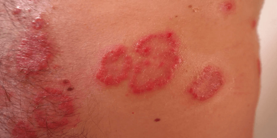 causes of skin rashes