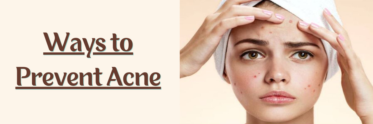 10 Best Ways to Prevent Acne 10 Best Ways to Prevent Acne