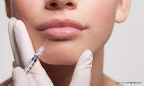Lip rejuvenation surgery