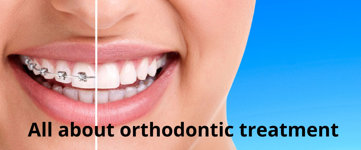 orthodontic treatment orthodontic treatment