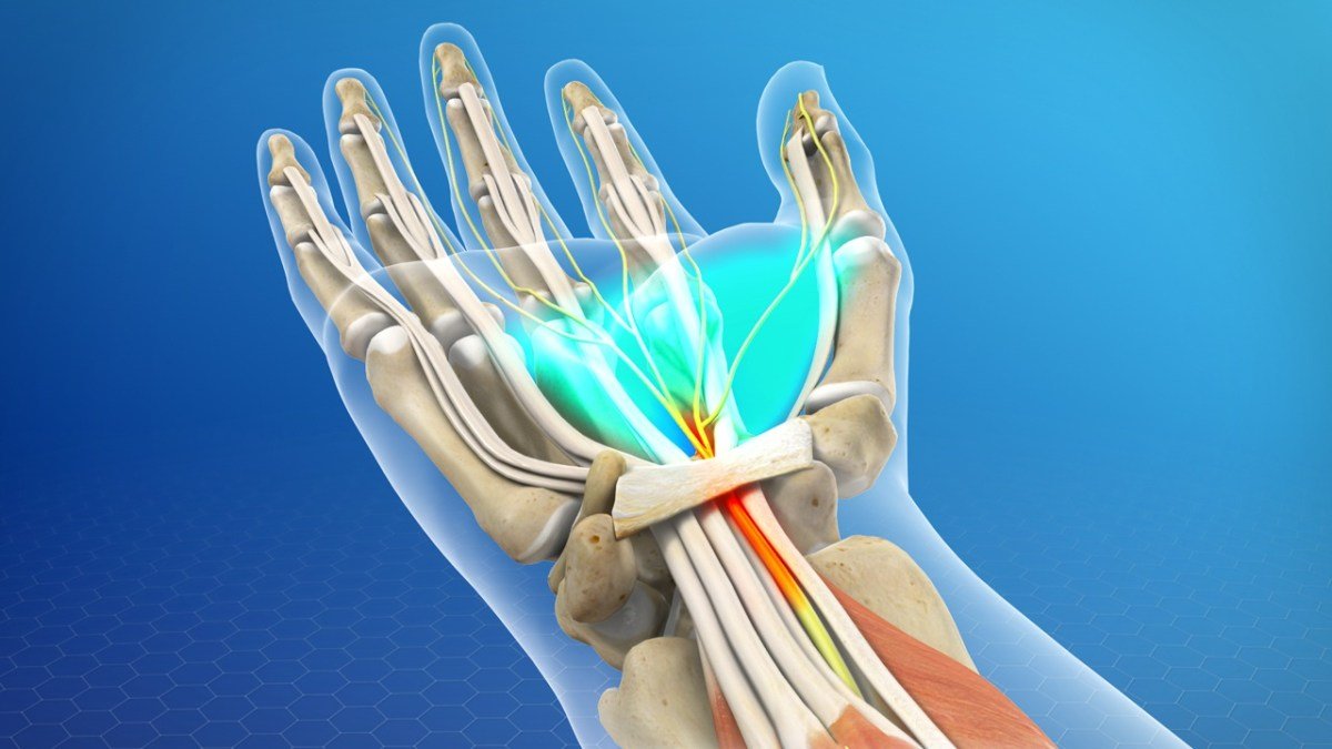 causes of wrist pain