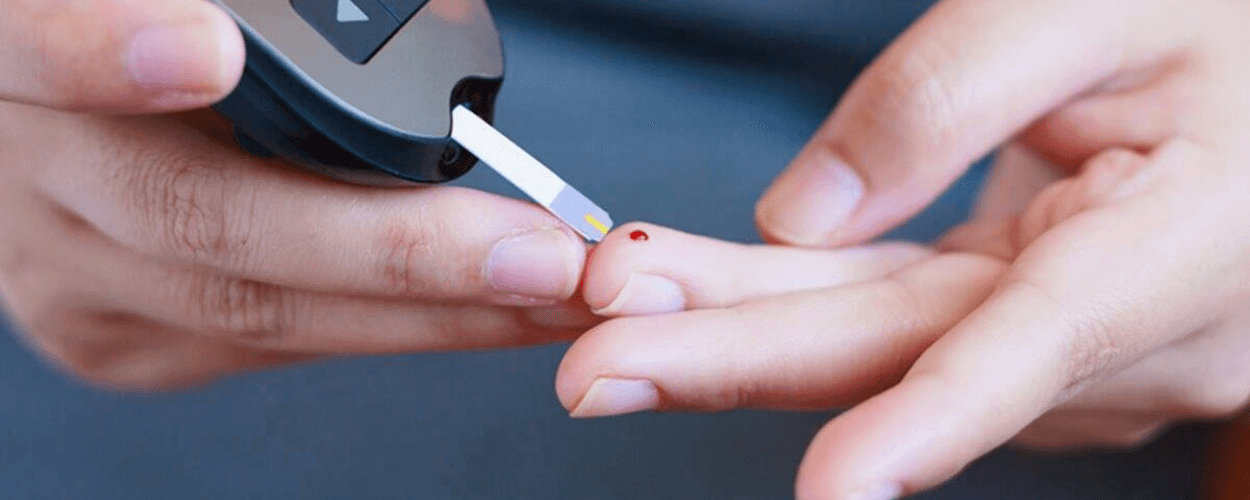 Diabetes and Covid 19 Diabetes and Covid 19