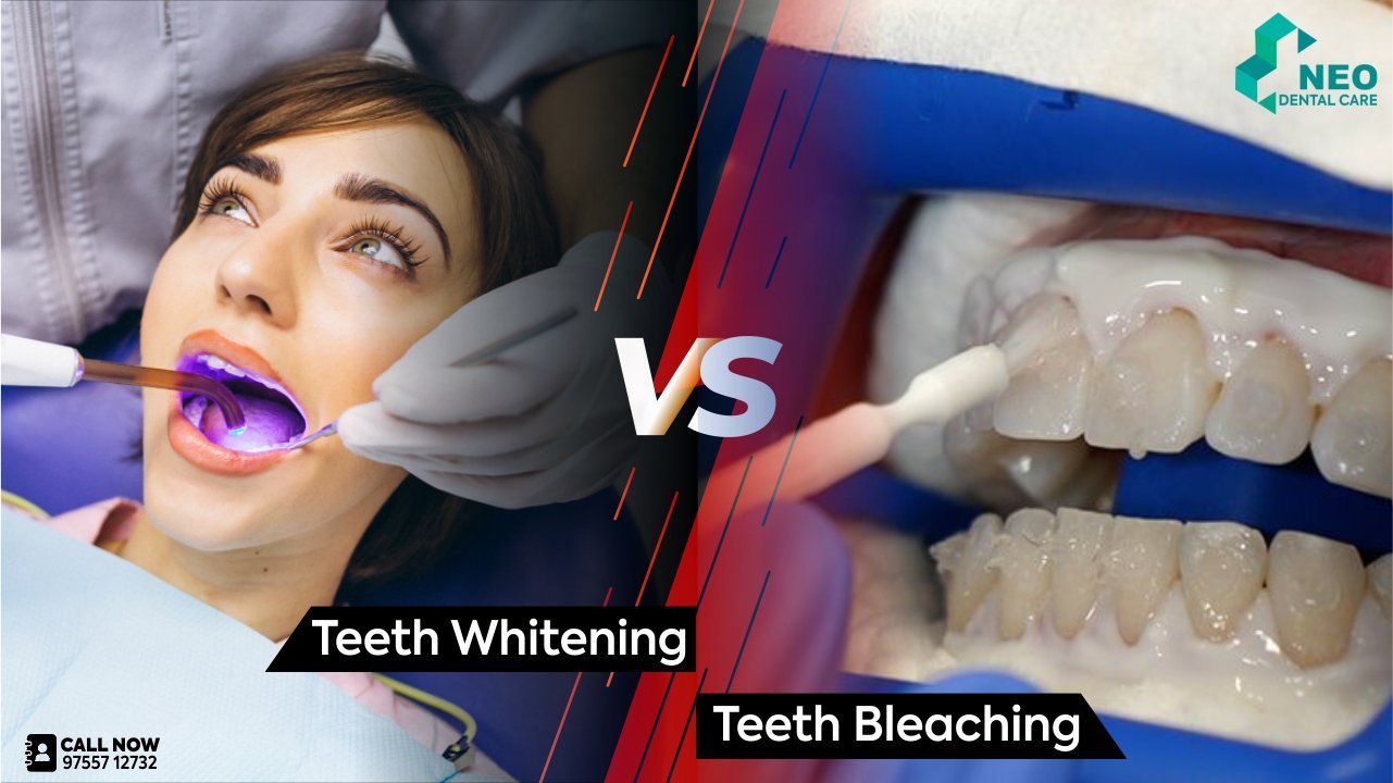 Difference between Teeth Whitening and Bleaching Difference between Teeth Whitening and Bleaching