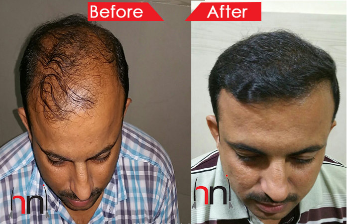 Before - After Images of Patient