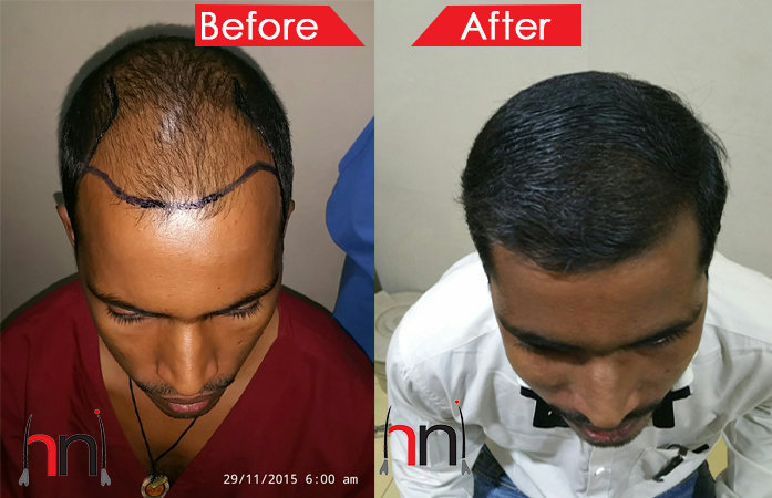 Before - After Image Before - After Image