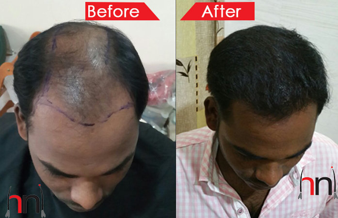 Before - After Image Before - After Image