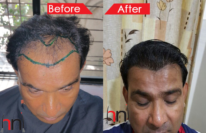 Before - After Image Before - After Image