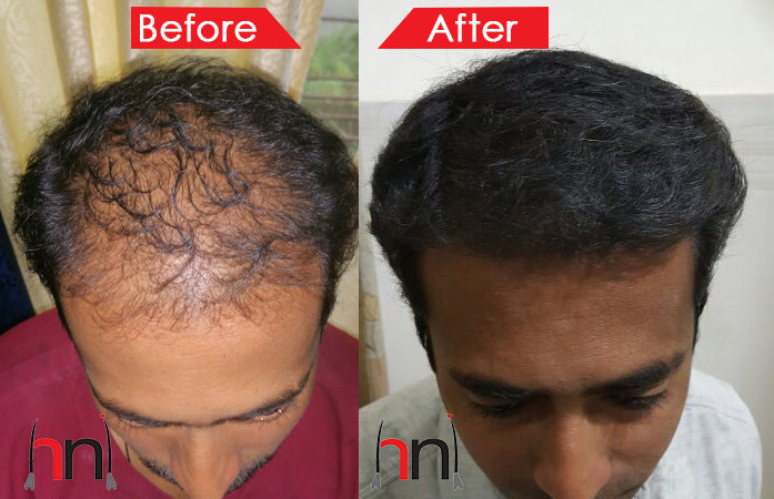 Before - After Image Before - After Image
