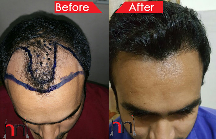 Before - After Image Before - After Image