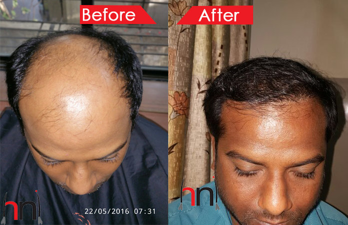 Before - After Image Before - After Image