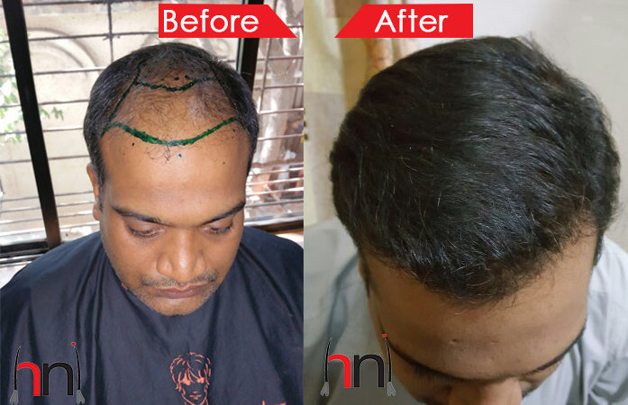 Before - After Image Before - After Image