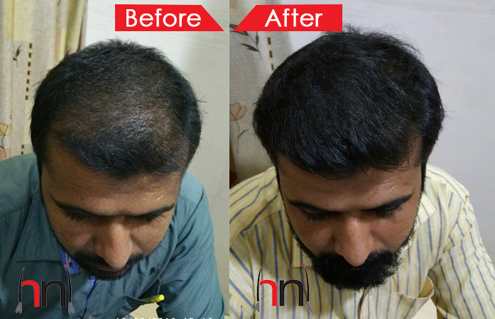 Before - After Image Before - After Image