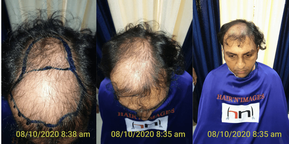 Contact us  Hair N Images Clinic in Surat India