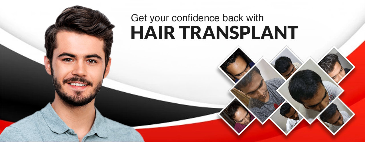 Hair Transplant Cost in Surat Gujarat india