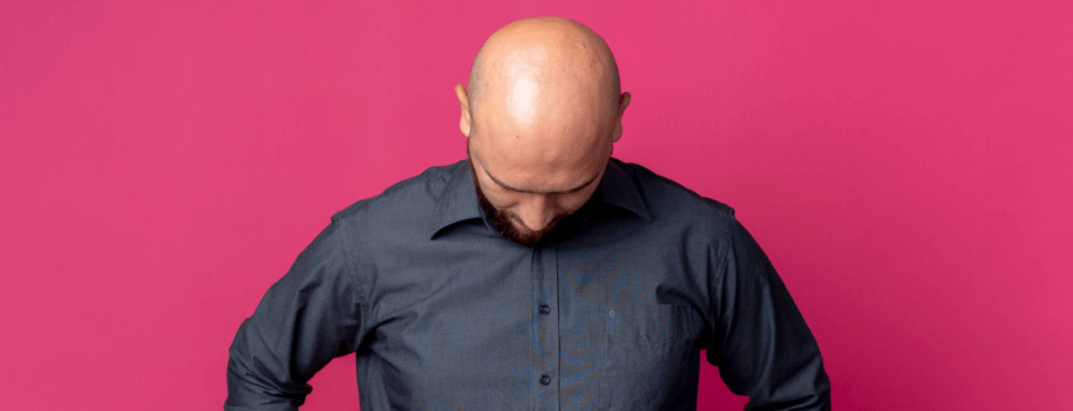 Androgenetic Alopecia Androgenetic Alopecia