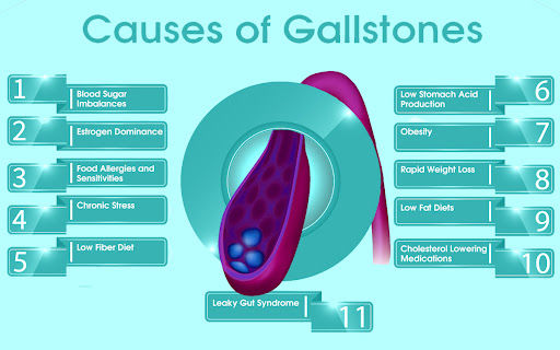 causes of gallstones