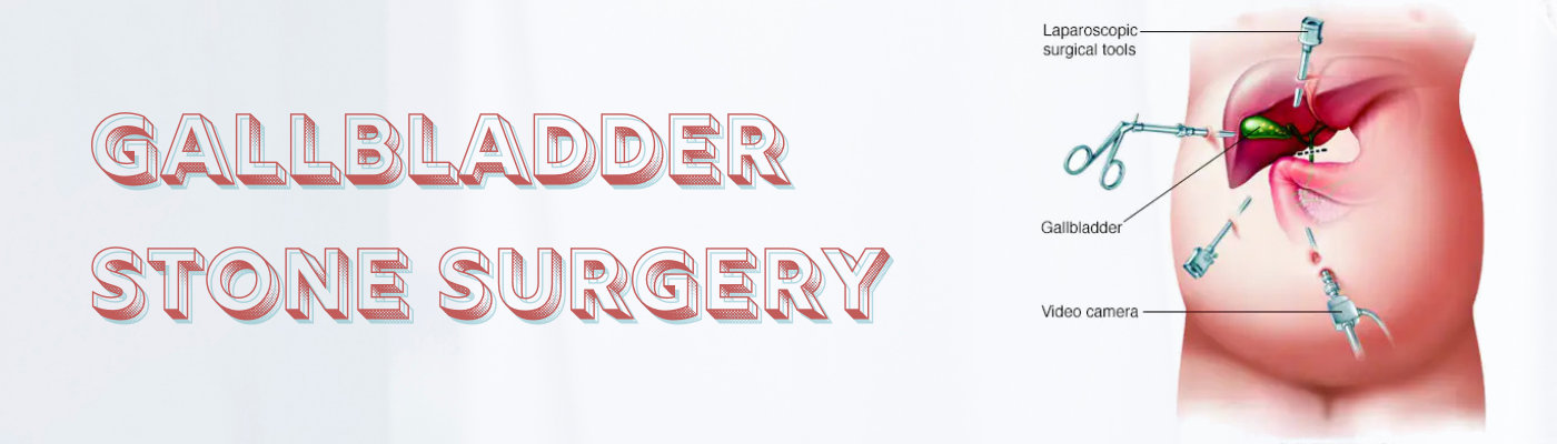 gallbladder stone surgery gallbladder stone surgery