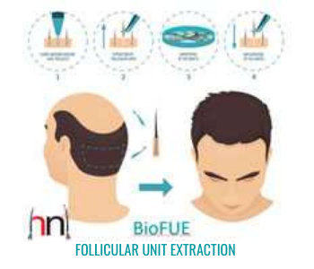 Hair N Images in Bharuch HOBharuch  Best Hair Loss Doctors in Bharuch   Justdial