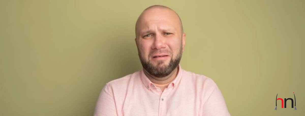 Does Hair Transplant Affect Existing Hair? Does Hair Transplant Affect Existing Hair?