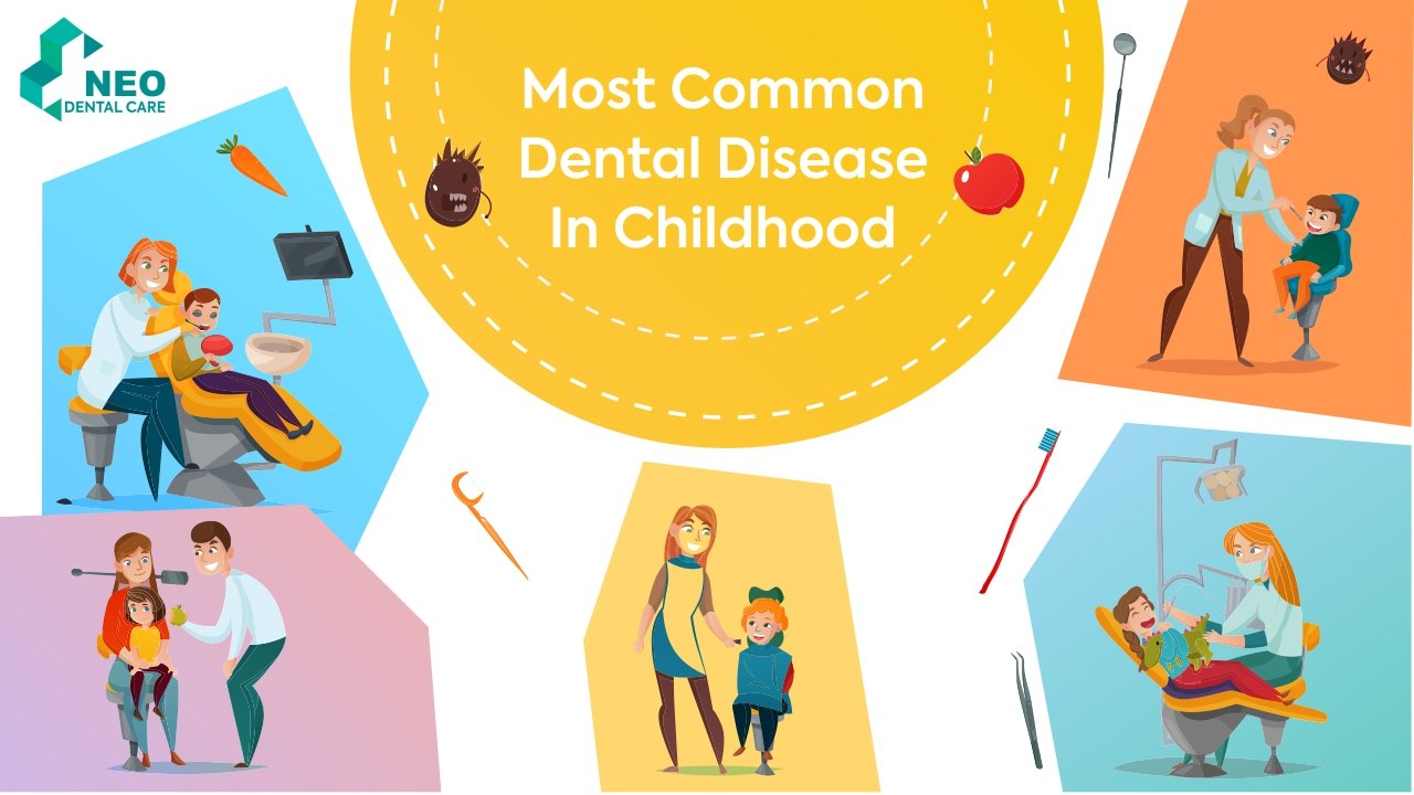 Most Common Dental Disease In Childhood Most Common Dental Disease In Childhood