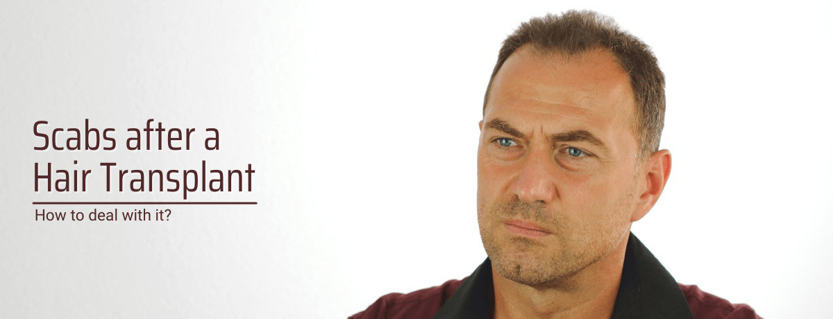scabs after a hair transplant scabs after a hair transplant