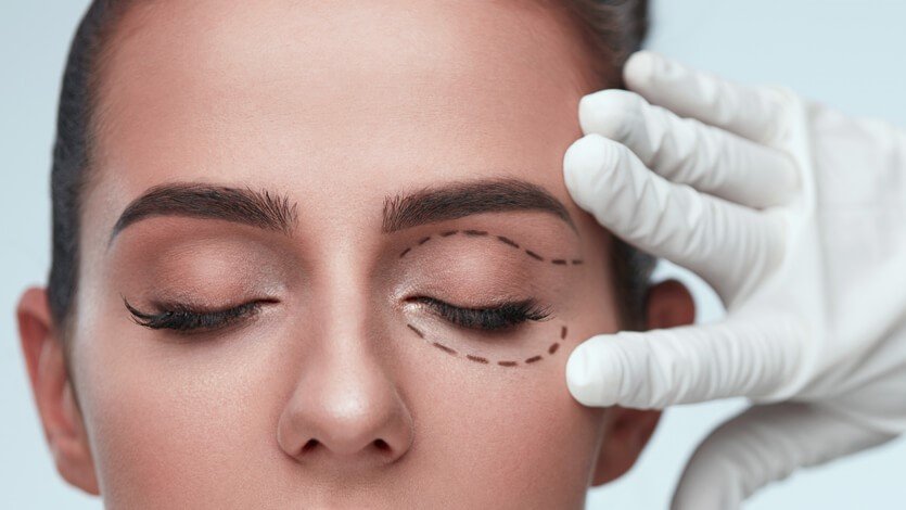 Eyelid Surgery in Jaipur Eyelid Surgery in Jaipur