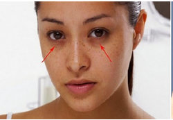 EYE Rejuvenation Treatments, Eye Treatment - Grow & Glow Health Care, Bengaluru | ID: 16688841030
