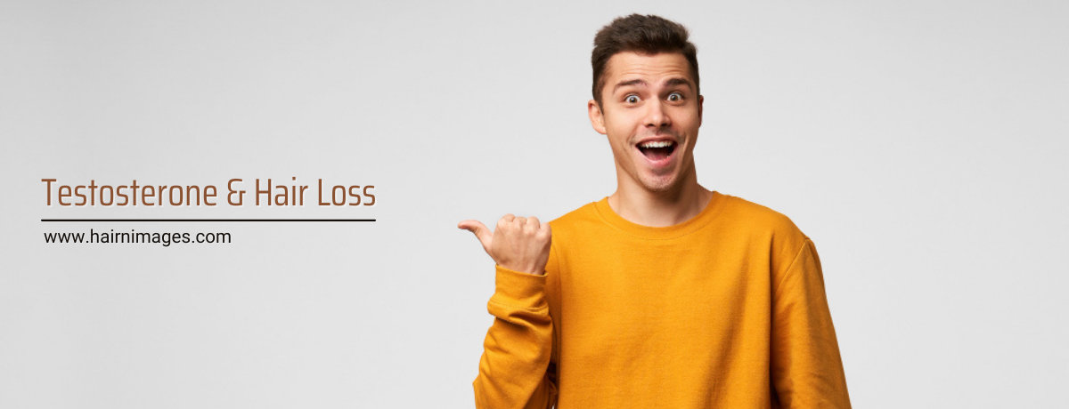 Testosterone and Hair Loss Testosterone and Hair Loss