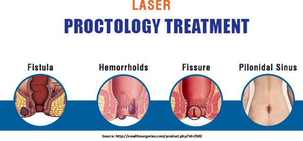 Proctology Treatment
