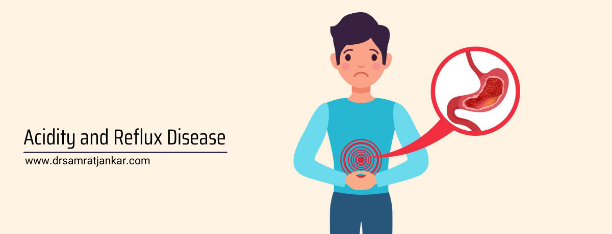 Acid reflux disease Acid reflux disease