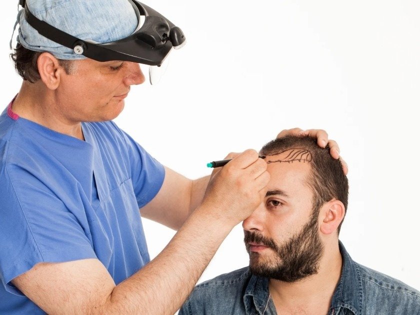 The danger of low cost hair transplant