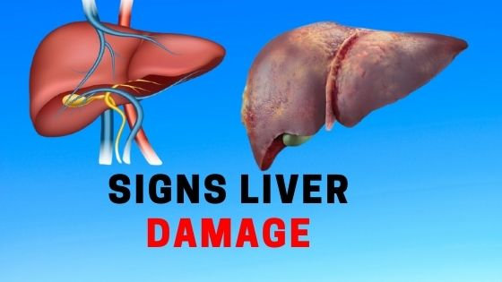 signs of liver damage