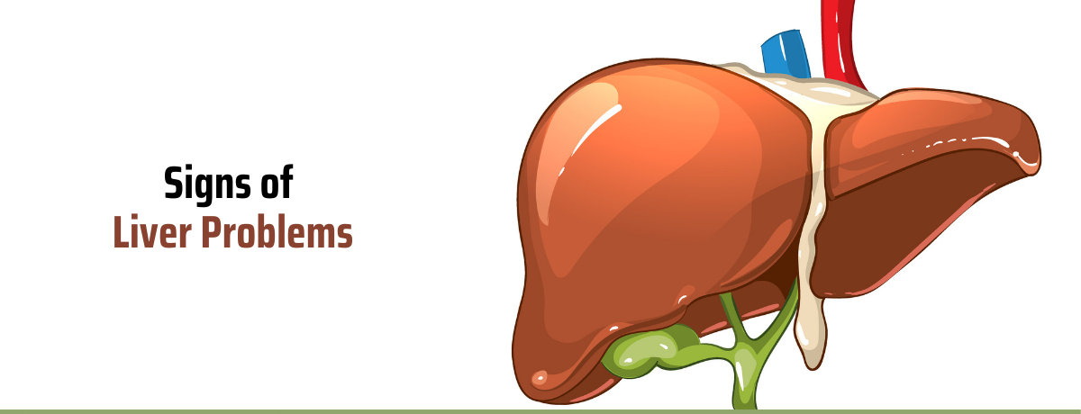 Signs of Liver Problems Signs of Liver Problems