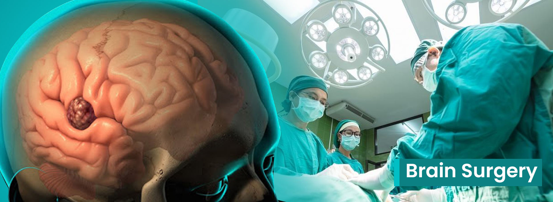 Brain Surgery in Mumbai