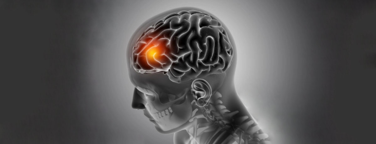Brain Tumor Surgery Brain Tumor Surgery